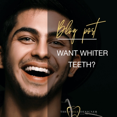 Want-Whiter-Teeth-400x400