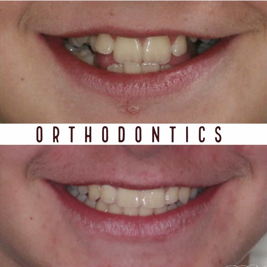 Orthodontics Preston Best Orthodontist Clinic Melbourne